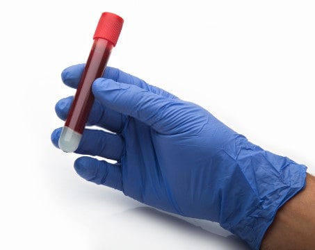 Pruebas clínicas por áreas de laboratorio perfil lipidico