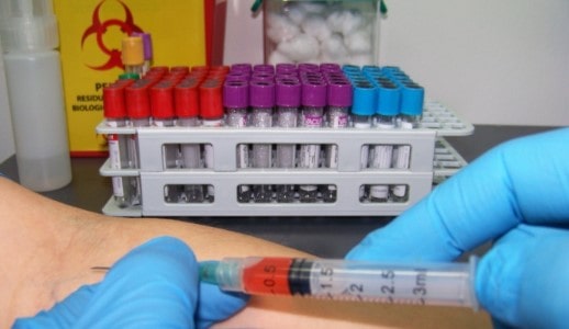 Pruebas clínicas por áreas de laboratorio serologia
