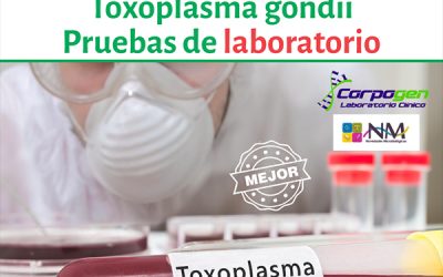 Prueba de toxoplasmosis Corpogen Prueba de toxoplasmosis Laboratorio Clínico Corpogen