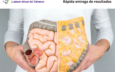 calprotectina (1) CALPROTECTINA FECAL